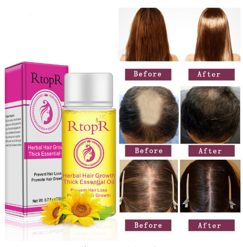 Fast Powerful Hair Growth Essence Products Essential Oil Liquid Treatment Preventing Hair Loss Hair Care 20ml